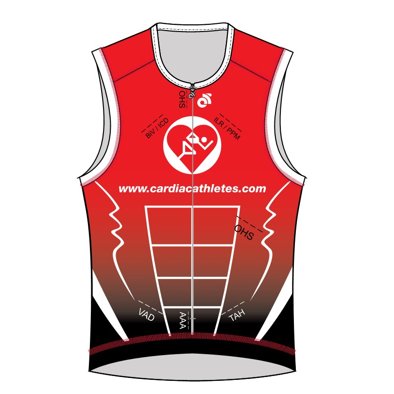 APEX Blade Tri Top